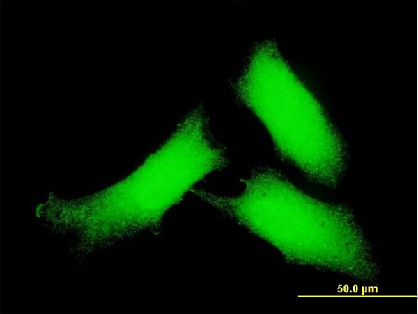 Immunofluorescence of monoclonal antibody to CAMK2D on HeLa cell . [antibody concentration 10 ug/ml]