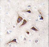 Formalin-fixed and paraffin-embedded human brain tissue reacted with CAMK2 delta Antibody , which was peroxidase-conjugated to the secondary antibody, followed by DAB staining. This data demonstrates the use of this antibody for immunohistochemistry; clinical relevance has not been evaluated.