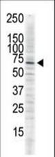 The anti-CAMK2delta C-term antibody is used in Western blot to detect CAMK2 delta in serum-starved HeLa cell lysate.