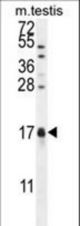 CAMK2N1 Antibody western blot of mouse testis tissue lysates (35 ug/lane). The CaMK2N1 antibody detected the CaMK2N1 protein (arrow).