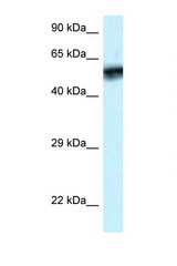 CAMK4 antibody LS-C145334 Western blot of ACHN Cell lysate. Antibody concentration 1 ug/ml.