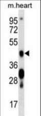 Mouse Camk4 Antibody western blot of mouse heart tissue lysates (35 ug/lane). The Camk4 antibody detected the Camk4 protein (arrow).