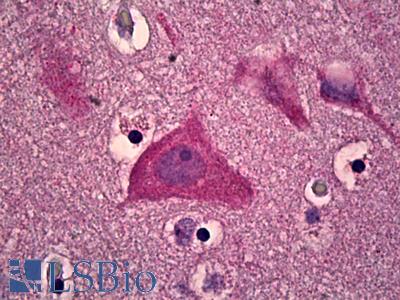 Anti-CAMKV antibody IHC of human brain, cortex. Immunohistochemistry of formalin-fixed, paraffin-embedded tissue after heat-induced antigen retrieval. Antibody LS-B6648 concentration 10 ug/ml.