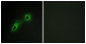 Immunofluorescence of HeLa cells, using CAMK5 Antibody. The picture on the right is treated with the synthesized peptide.