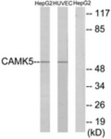 Western blot of extracts from HepG2/HUVEC cells, using CAMK5 Antibody. The lane on the right is treated with the synthesized peptide.