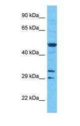 Western blot of CAMKV Antibody with human RPMI-8226 Whole Cell lysate.