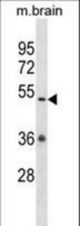 Mouse Camkv Antibody western blot of mouse brain tissue lysates (35 ug/lane). The Camkv antibody detected the Camkv protein (arrow).