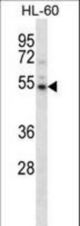 Mouse Camkv Antibody western blot of HL-60 cell line lysates (35 ug/lane). The Camkv antibody detected the Camkv protein (arrow).
