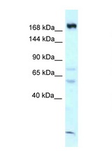 CAMSAP1 antibody LS-C145813 Western blot of Mouse Thymus lysate. Antibody concentration 1 ug/ml.