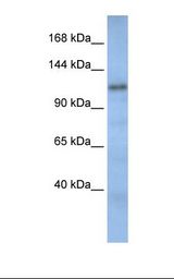 Fetal muscle lysate. Antibody concentration: 1.0 ug/ml. Gel concentration: 6-18%.