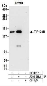Detection of Human TIP120B by Western Blot of Immunoprecipitates. Samples: Whole cell lysate (1 mg for IP; 20% of IP loaded) from 293T cells. Antibodies: Affinity purified rabbit anti-TIP120B antibody used for IP at 6 ug/mg lysate. TIP120B was also immunoprecipitated by rabbit anti-TIP120B antibody BL14617. For blotting immunoprecipitated TIP120B, was used at 0.2 ug/ml. Detection: Chemiluminescence with an exposure time of 30 seconds.
