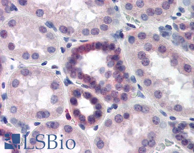 Anti-CAND2 / TIP120B antibody IHC of human kidney. Immunohistochemistry of formalin-fixed, paraffin-embedded tissue after heat-induced antigen retrieval. Antibody LS-B348 dilution 1:500.