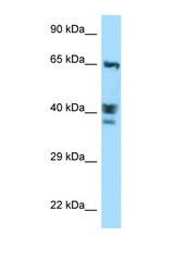 ACTL8 antibody LS-C146166 Western blot of MCF7 Cell lysate. Antibody concentration 1 ug/ml.