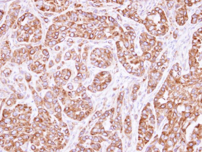 IHC of paraffin-embedded A549 xenograft using ACTL8 antibody at 1:500 dilution.