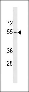 ACTL9 Antibody western blot of A2058 cell line lysates (35 ug/lane). The ACTL9 antibody detected the ACTL9 protein (arrow).