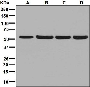 Western blot analysis on (A) HepG2, (B) 293T, (C) K562, and (D) Raji cell lysates using anti-CAP1 antibody.