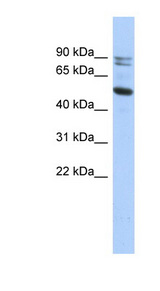 CAPN10 / Calpain 10 antibody LS-C102425 Western blot of HT1080 cell lysate.