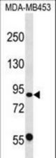 CAPN13 Antibody western blot of MDA-MB453 cell line lysates (35 ug/lane). The CAPN13 antibody detected the CAPN13 protein (arrow).