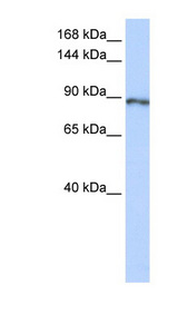 SOLH antibody LS-C110303 Western blot of Fetal Lung lysate.
