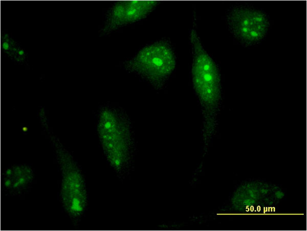Immunofluorescence of monoclonal antibody to SOLH on HeLa cell . [antibody concentration 10 ug/ml]