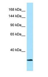 CAPN3 / Calpain 3 antibody Western Blot of HT1080.
