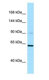 CAPN3 / Calpain 3 antibody Western Blot of OVCAR-3.