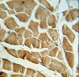 CAPN3 Antibody IHC of formalin-fixed and paraffin-embedded skeletal muscle followed by peroxidase-conjugated secondary antibody and DAB staining.
