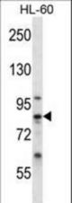 CAPN6 Antibody western blot of HL-60 cell line lysates (35 ug/lane). The CAPN6 antibody detected the CAPN6 protein (arrow).