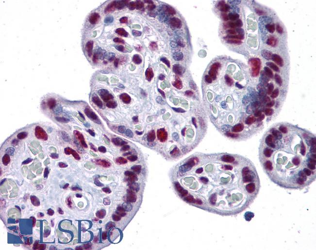 Anti-CAPN6 / Calpain 6 antibody IHC of human placenta. Immunohistochemistry of formalin-fixed, paraffin-embedded tissue after heat-induced antigen retrieval. Antibody LS-B4597 concentration 5 ug/ml.