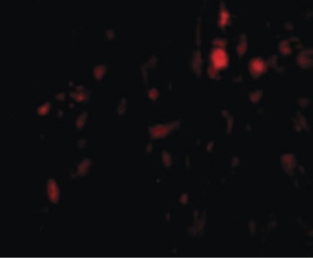 Immunofluorescence of CAPN6 in Human Lung cells with CAPN6 antibody at 20 ug/ml.