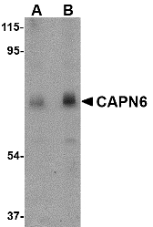 Western blot of CAPN6 in rat lung tissue lysate with CAPN6 antibody at (A) 0.5 and (B) 1 ug/ml.