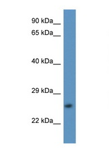 CAPNS2 / Calpain S2 antibody LS-C135503 Western blot of Fetal Liver lysate. Antibody concentration 1 ug/ml.