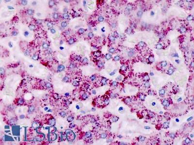 Human, Liver: Formalin-Fixed Paraffin-Embedded (FFPE)