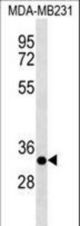 CAPNS2 Antibody western blot of MDA-MB231 cell line lysates (35 ug/lane). The CAPNS2 antibody detected the CAPNS2 protein (arrow).