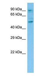 CAPRIN1 antibody Western Blot of 293T cell lysate.