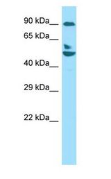 CAPRIN1 antibody Western Blot of 293T cell lysate.