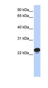 CAPS antibody LS-C102778 Western blot of 293T cell lysate.