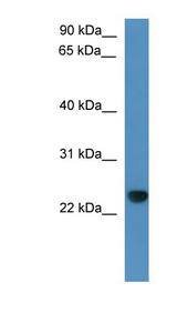 CAPSL antibody LS-C135287 Western blot of Rat Liver lysate.
