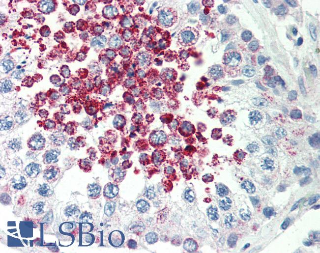 Anti-CARD10 antibody IHC of human testis. Immunohistochemistry of formalin-fixed, paraffin-embedded tissue after heat-induced antigen retrieval. Antibody LS-B470 concentration 5 ug/ml.
