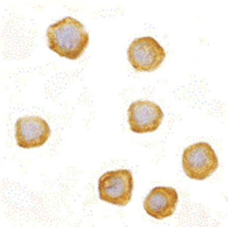 Immunocytochemistry of CARD10 in EL4 cells with CARD10 antibody at 10 ug/ml.