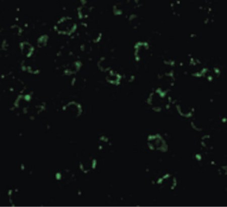 Immunofluorescence of CARD10 in EL4 cells with CARD10 antibody at 20 ug/ml.