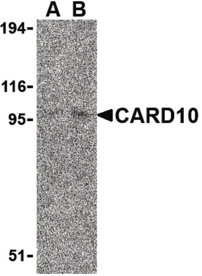 Western blot of CARD10 expression in EL4 cell lysate with CARD10 antibody at (A) 5 and (B) 10 ug /ml.