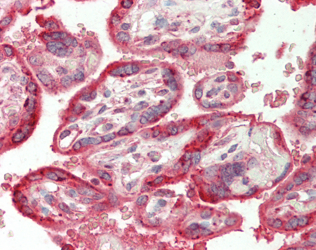 Human Placenta: Formalin-Fixed, Paraffin-Embedded (FFPE)
