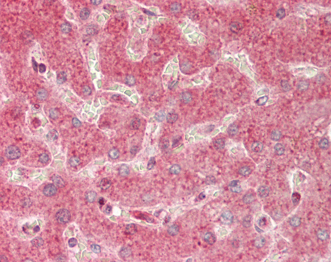 Human Liver: Formalin-Fixed, Paraffin-Embedded (FFPE)