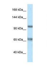 CARD10 antibody LS-C145818 Western blot of HT1080 Cell lysate. Antibody concentration 1 ug/ml.