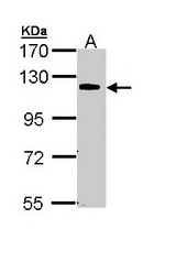 Sample (30 ug of whole cell lysate). A: 293T. 7.5% SDS PAGE. CARD10 antibody diluted at 1:1000.