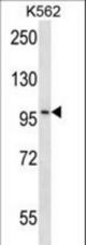 CARD10 Antibody western blot of K562 cell line lysates (35 ug/lane). The CARD10 antibody detected the CARD10 protein (arrow).