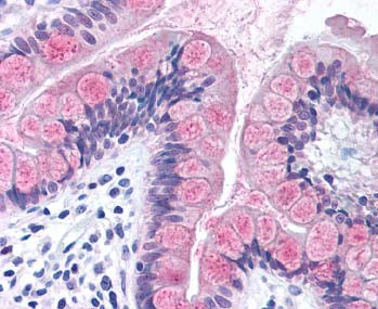 Localization of the antibody as the precipitated red signal, with a hematoxylin purple nuclear counterstain in intestinal epithelium