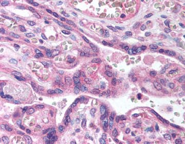 Localization of the antibody as the precipitated red signal, with a hematoxylin purple nuclear counterstain in placental trophoblasts