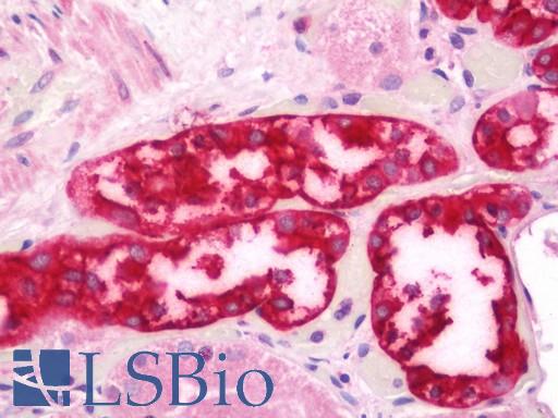 Anti-CARD14 antibody IHC staining of human kidney. Immunohistochemistry of formalin-fixed, paraffin-embedded tissue after heat-induced antigen retrieval. Antibody LS-B11378 concentration 20 ug/ml.